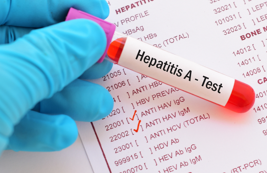 Hepatitis A